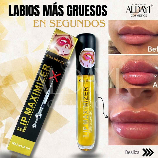 Labios Gruesos
